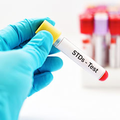 STDs lab testing